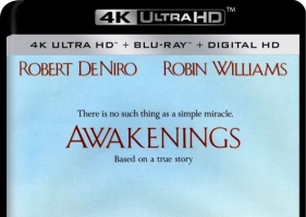 无语问苍天4k.Awakenings.1990.Hybrid.2160p.WEB-DL.DoVi.HDR10+H.265.DTS-HD.MA.5.1-4k电影下载